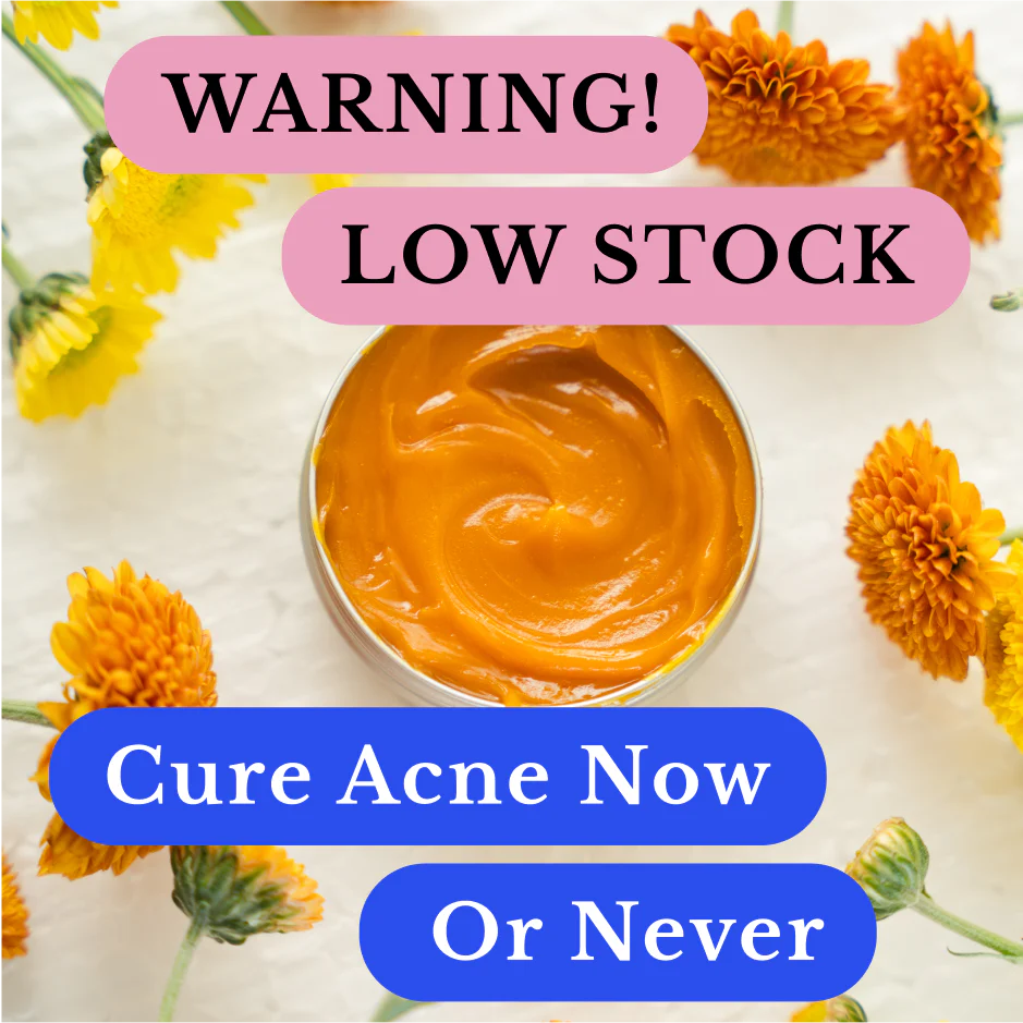 Kill Acne & Redness Ritual - Bundle