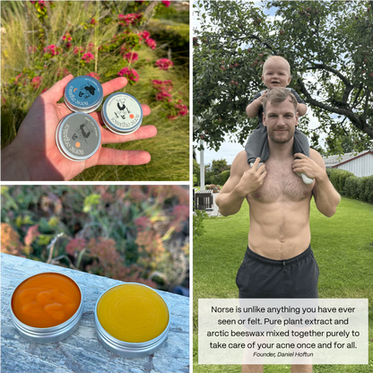 Kill Acne & Redness Ritual - Bundle