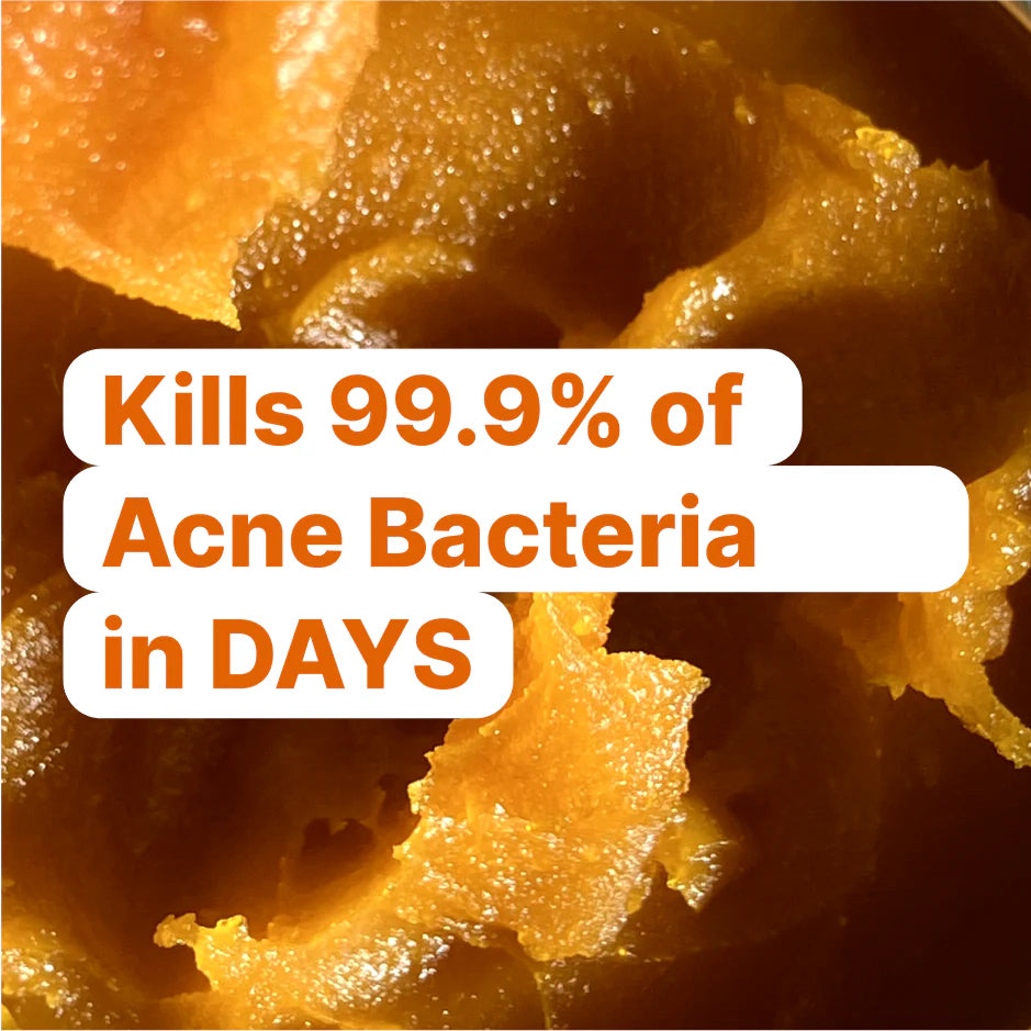 Kill Acne & Redness Ritual - Bundle